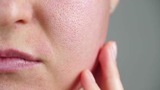 Unclog skin pores